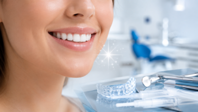 diamond smile erfahrungen